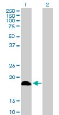 Western Blot: Deoxycytidylate deaminase Antibody [H00001635-D01P] - Analysis of DCTD expression in transfected 293T cell line by DCTD polyclonal antibody.Lane 1: DCTD transfected lysate(21.00 KDa).Lane 2: Non-transfected lysate.