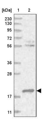 Western Blot: Deoxycytidylate deaminase Antibody [NBP1-87424] - Lane 1: Marker  [kDa] 230, 130, 95, 72, 56, 36, 28, 17, 11.  Lane 2: Human cell line RT-160