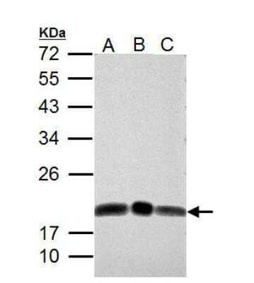 Western Blot: Deoxycytidylate deaminase Antibody [NBP2-16149] - Sample (30 ug of whole cell lysate)  A: NT2D1 B: U87-MG C: SK-N-SH 12% SDS PAGE diluted at 1:1000