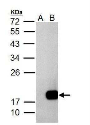 Western Blot: Deoxycytidylate deaminase Antibody [NBP2-16149] - Sample (30 ug of whole cell lysate) A: Non-transfected 293T lysates B: DCTD transfected 293T lysates 12% SDS PAGE  diluted at 1:5000