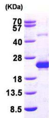 Western Blot Recombinant Human Deoxycytidylate deaminase His Protein