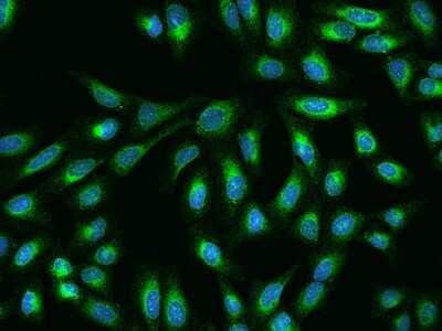 Immunocytochemistry/ Immunofluorescence Derlin 1 Antibody