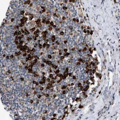 Immunohistochemistry-Paraffin: Derlin 1 Antibody [NBP1-88023] - Staining of human tonsil shows moderate to strong cytoplasmic positivity in lymphoid cells.