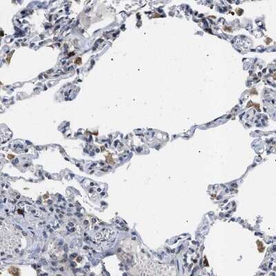 Immunohistochemistry-Paraffin: Derlin 1 Antibody [NBP1-88023] - Staining of human lung shows moderate to strong cytoplasmic positivity in macrophages.