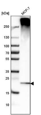 Western Blot: Derlin 1 Antibody [NBP1-88023] - Analysis in human cell line MCF-7.