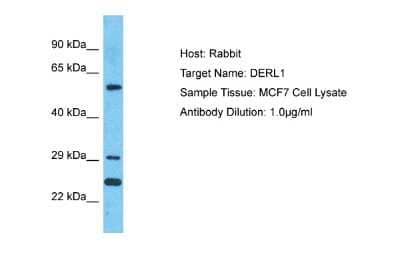 Western Blot: Derlin 1 Antibody [NBP2-84778] - Host: Rabbit. Target Name: DERL1. Sample Type: MCF7 Whole Cell lysates. Antibody Dilution: 1.0ug/ml