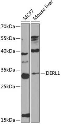 Western Blot: Derlin 1 Antibody [NBP2-92553] - Analysis of extracts of various cell lines, using Derlin 1 at 1:1000 dilution.Secondary antibody: HRP Goat Anti-Rabbit IgG (H+L) at 1:10000 dilution.Lysates/proteins: 25ug per lane.Blocking buffer: 3% nonfat dry milk in TBST.Detection: ECL Basic Kit .Exposure time: 90s.