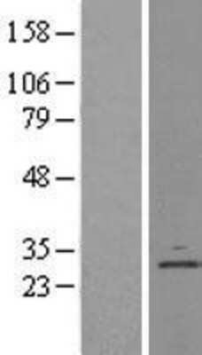 Western Blot Derlin 1 Overexpression Lysate