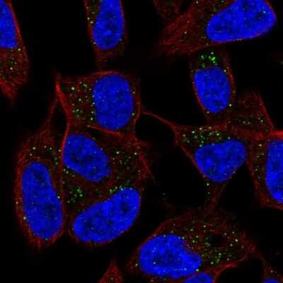 Immunocytochemistry/Immunofluorescence: Dermatopontin Antibody [NBP2-56549] - Staining of human cell line SH-SY5Y shows localization to vesicles. Antibody staining is shown in green.