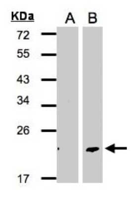 Western Blot: Dermatopontin Antibody [NBP2-14930] - A: Non-transfected lysate. B: DPT transfected lysate. 12% SDS PAGE, antibody diluted at 1:500.