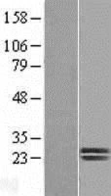 Western Blot: Dermatopontin Overexpression Lysate (Adult Normal) [NBL1-10005] Left-Empty vector transfected control cell lysate (HEK293 cell lysate); Right -Over-expression Lysate for Dermatopontin.