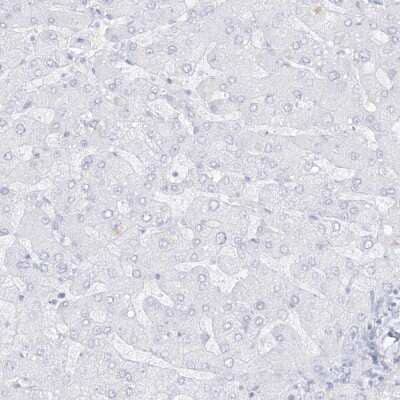 Immunohistochemistry-Paraffin Dermokine beta Antibody