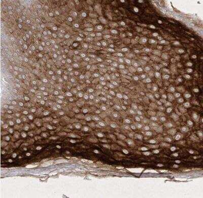 Immunohistochemistry-Paraffin: Dermokine beta Antibody [NBP1-86840] - Staining of human skin shows strong cytoplasmic positivity in squamous epithelial cells.
