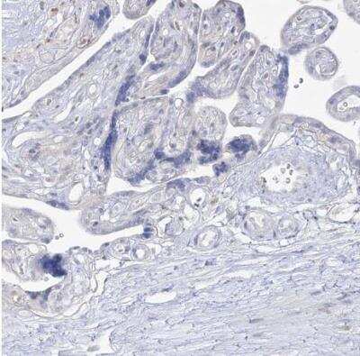 Immunohistochemistry-Paraffin: Dermokine beta Antibody [NBP1-86840] - Staining of human placenta shows no positivity in trophoblastic cells as expected.