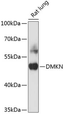 Western Blot: Dermokine beta Antibody [NBP2-92134] - Analysis of extracts of rat ovary, using Dermokine beta at 1:3000 dilution.Secondary antibody: HRP Goat Anti-Rabbit IgG (H+L) at 1:10000 dilution.Lysates/proteins: 25ug per lane.Blocking buffer: 3% nonfat dry milk in TBST.Detection: ECL Basic Kit .Exposure time: 1s.