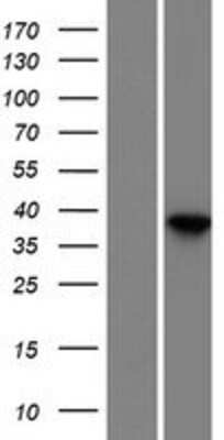 Western Blot: Dermokine beta Overexpression Lysate (Adult Normal) [NBP2-11393] Left-Empty vector transfected control cell lysate (HEK293 cell lysate); Right -Over-expression Lysate for Dermokine beta.