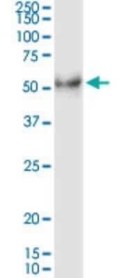 Western Blot: Desert Hedgehog/Dhh Antibody (2D5) [H00050846-M02] - DHH monoclonal antibody (M02), clone 2D5. Analysis of DHH expression in human liver.