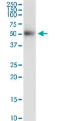 Western Blot: Desert Hedgehog/Dhh Antibody (3E6) [H00050846-M03] - Analysis of DHH expression in human colon.