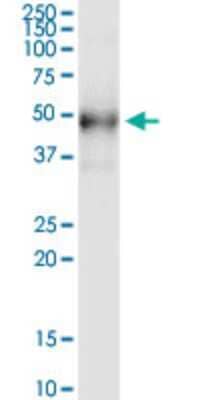 Western Blot: Desert Hedgehog/Dhh Antibody (4F10) [H00050846-M01] - DHH monoclonal antibody (M01), clone 4F10. Analysis of DHH expression in human colon.