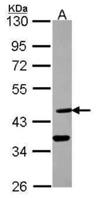 Western Blot: Desert Hedgehog/Dhh Antibody [NBP2-42834] - Analysis of 30 ug whole cell lysate. A: A431 10% SDS PAGE diluted at 1:10000.