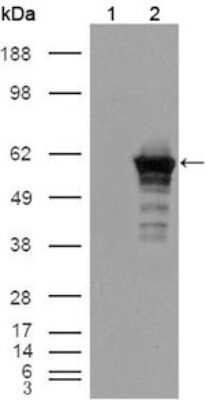 Western Blot: Desmin Antibody (10H7D2) [NB110-60508] - Analysis using Desmin mouse mAb against HEK293T cells transfected with the pCMV6-ENTRY control (1) and pCMV6-ENTRY Desmin cDNA (2).