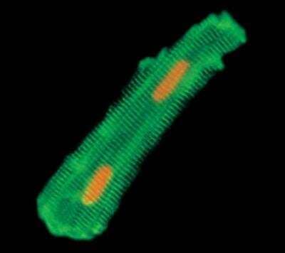 Immunocytochemistry/Immunofluorescence: Desmin Antibody (DE-U-10) [NB110-1790] - Cardiomyocyte isolated from rat heart stained using monoclonal anti-Desmin Antibody (NB110-1790). The cross-striation corresponding to the Z bands is evident. Some striations are continuously crossing the cell, others show branching that is equivalent to the course of the sarcomeres. Due to the isolation procedure, the cell contains only one membrane of the intercalated disc at both ends that labels for desmin. Nuclei are stained with propidium iodide.  Data supplied by Prof. Dr. J. Schaper and Dr. S. Hein, Max Planck Institute, Bad Nauheim, Germany.