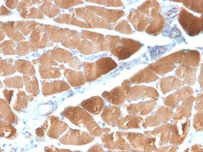 Immunohistochemistry-Paraffin: Desmin Antibody (DES/2960R) [NBP3-07640] - Formalin-fixed, paraffin-embedded human Skeletal Muscle stained with Desmin Rabbit Recombinant Monoclonal Antibody (DES/2960R).