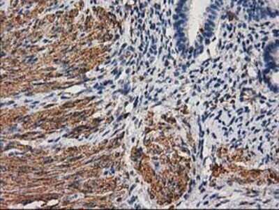 Immunohistochemistry: Desmin Antibody (OTI4G1) - Azide and BSA Free [NBP2-70565] - Staining of paraffin-embedded Human endometrium tissue using anti-Desmin mouse monoclonal antibody.