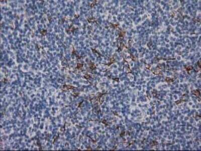 Immunohistochemistry: Desmin Antibody (OTI4G1) - Azide and BSA Free [NBP2-70565] - Staining of paraffin-embedded Human lymph node tissue using anti-Desmin mouse monoclonal antibody.