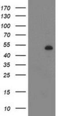 Western Blot: Desmin Antibody (OTI4G1) - Azide and BSA Free [NBP2-70565] - HEK293T cells were transfected with the pCMV6-ENTRY control (Left lane) or pCMV6-ENTRY Desmin (Right lane) cDNA for 48 hrs and lysed. Equivalent amounts of cell lysates (5 ug per lane) were separated by SDS-PAGE and immunoblotted with anti-Desmin.