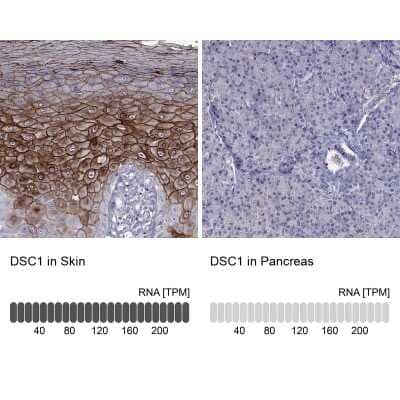 <b>Orthogonal Strategies Validation. </b>Immunohistochemistry-Paraffin: Desmocollin-1 Antibody [NBP2-62695] - Analysis in human skin and pancreas tissues using Anti-DSC1 antibody. Corresponding DSC1 RNA-seq data are presented for the same tissues.