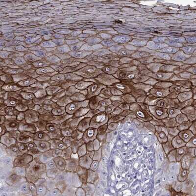 Immunohistochemistry-Paraffin: Desmocollin-1 Antibody [NBP2-62695] - Staining of human skin shows high expression.