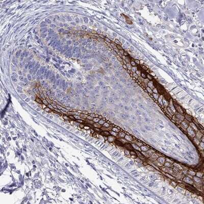 Immunohistochemistry-Paraffin: Desmocollin-1 Antibody [NBP2-62695] - Staining of human hair shows strong membranous and cytoplasmic positivity in internal root sheath.