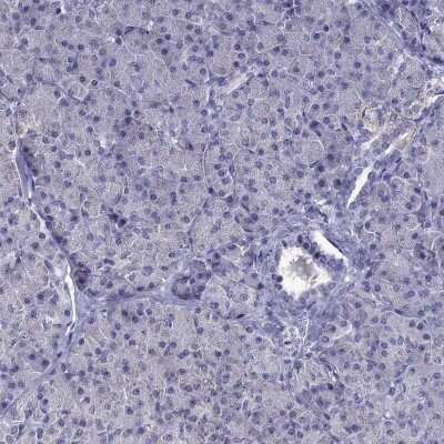 Immunohistochemistry-Paraffin: Desmocollin-1 Antibody [NBP2-62695] - Staining of human pancreas shows low expression as expected.