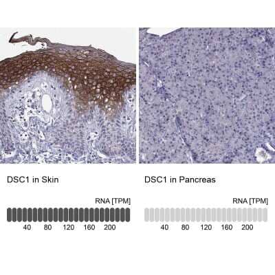 Immunohistochemistry-Paraffin: Desmocollin-1 Antibody [NBP2-62695] - Analysis in human skin and pancreas tissues using NBP2-62695 antibody. Corresponding DSC1 RNA-seq data are presented for the same tissues.