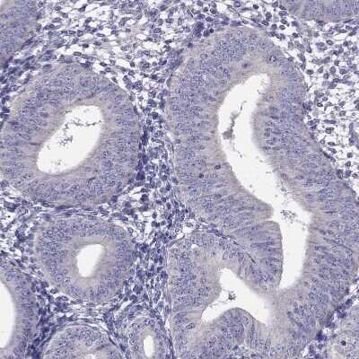 Immunohistochemistry-Paraffin: Desmocollin-1 Antibody [NBP2-62695] - Staining of human Endometrium shows no positivity in glandular cells as expected.