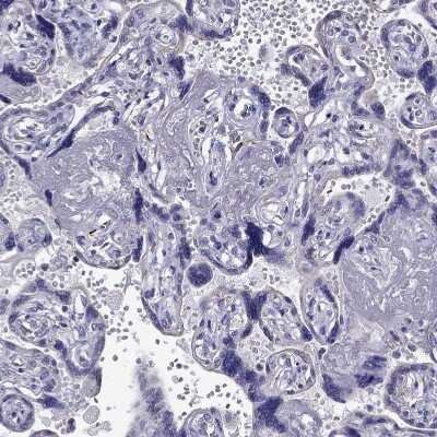 Immunohistochemistry-Paraffin: Desmocollin-1 Antibody [NBP2-62695] - Staining of human Placenta shows no positivity in trophoblastic cells as expected.