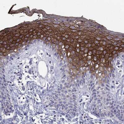 Immunohistochemistry-Paraffin: Desmocollin-1 Antibody [NBP2-62695] - Staining of human Skin shows strong membranous positivity in squamous epithelial cells.