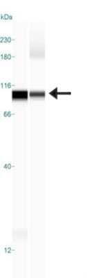 Simple Western: Desmocollin-1 Antibody [NBP1-88099] - Simple Western lane view shows a specific band for Desmocollin-1 in 0.5 mg/ml of RT-4 (Left) and U-251MG (Right) lysate. This experiment was performed under reducing conditions using the 12-230 kDa separation system.