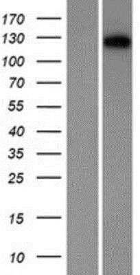 Western Blot: Desmocollin 1 Overexpression Lysate (Native) [NBP2-06335] - Desmocollin 1 Overexpression Lysate (Native) Left-Empty vector transfected control cell lysate (HEK293 cell lysate); Right -Over-expression Lysate for Desmosomal Protein.