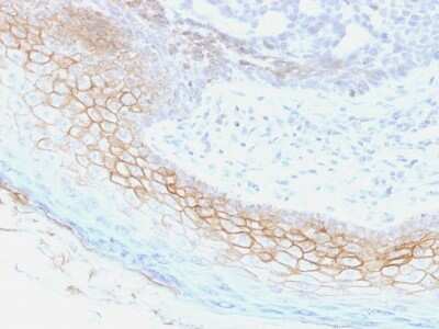 Immunohistochemistry-Paraffin: Desmocollin-2 Antibody (7G6) - Azide and BSA Free [NBP2-54519] - Formalin-fixed, paraffin-embedded human Skin stained with Desmocollin-2/3 Monoclonal Antibody (7G6).