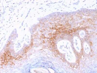 Immunohistochemistry-Paraffin: Desmocollin-2 Antibody (7G6) - Azide and BSA Free [NBP2-54519] - Formalin-fixed, paraffin-embedded human Skin stained with Desmocollin-2 Antibody (7G6).