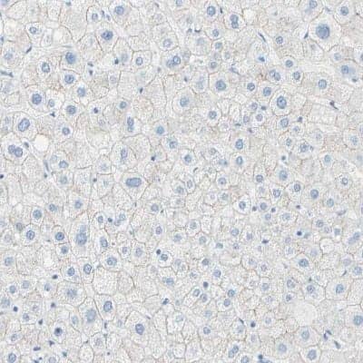 Immunohistochemistry-Paraffin: Desmocollin-2 Antibody [NBP1-85710] - Staining of human liver shows weak membranous positivity in hepatocytes.