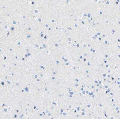 <b>Independent Antibodies Validation. </b>Immunohistochemistry-Paraffin: Desmocollin-2 Antibody [NBP1-85711] - Staining of human cerebral cortex shows no positivity in neurons as expected.