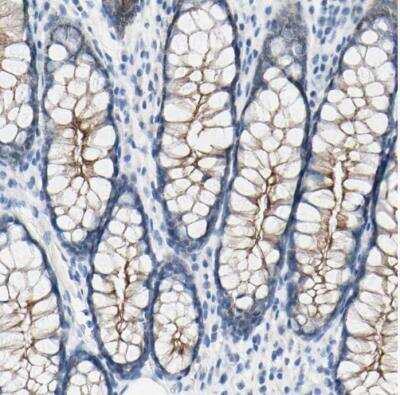 Immunohistochemistry-Paraffin: Desmocollin-2 Antibody [NBP1-85711] - Staining of human colon shows moderate membranous positivity in glandular cells.