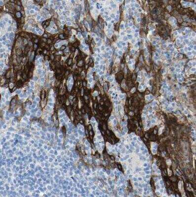 Immunohistochemistry-Paraffin: Desmocollin-2 Antibody [NBP1-85711] - Staining of human tonsil shows strong membranous positivity in squamous epithelial cells.