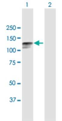 Western Blot: Desmocollin-2 Antibody [H00001824-B01P] - Analysis of DSC2 expression in transfected 293T cell line by DSC2 polyclonal antibody.  Lane 1: DSC2 transfected lysate(93.17 KDa). Lane 2: Non-transfected lysate.
