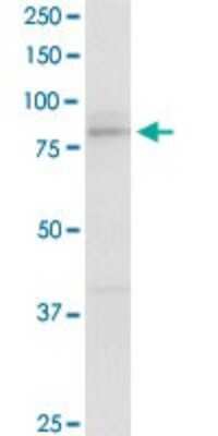 Western Blot: Desmocollin-2 Antibody [H00001824-D01P] - Analysis of DSC2 expression in human stomach.