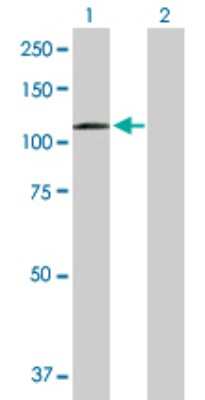 Western Blot: Desmocollin-2 Antibody [H00001824-D01P] - Analysis of DSC2 expression in transfected 293T cell line by DSC2 polyclonal antibody.Lane 1: DSC2 transfected lysate(93.80 KDa).Lane 2: Non-transfected lysate.