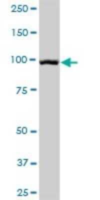 Western Blot: Desmoglein-1 Antibody [H00001828-B01P] - Analysis of DSG1 expression in human colon.